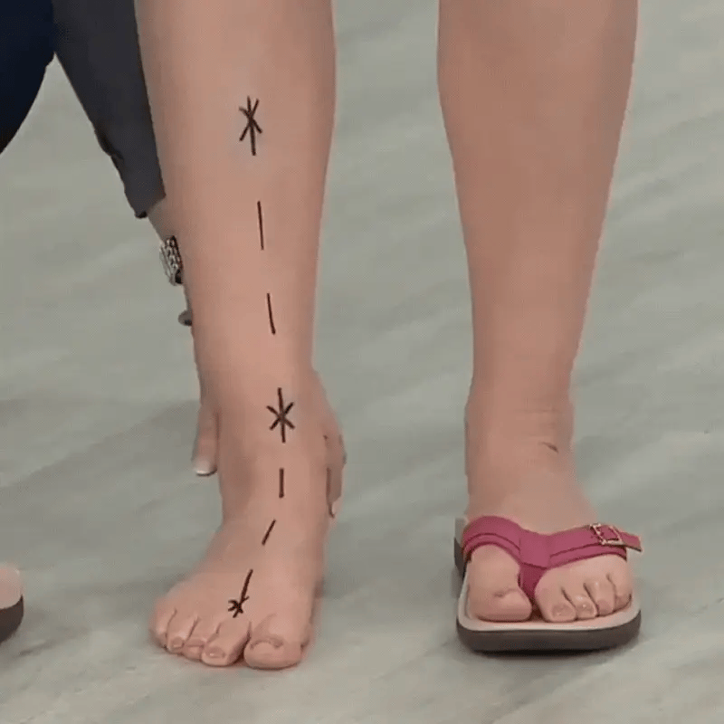 Nelly | Orthopädische Sommersandalen für ultimativen Komfort
